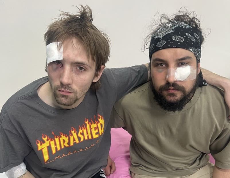 SafeJournalists i EFJ: Brutalni napadi na novinare i novinarke koji su izveštavali o lokalnim izborima u Srbiji zahtevaju hitan odgovor nadležnih organa