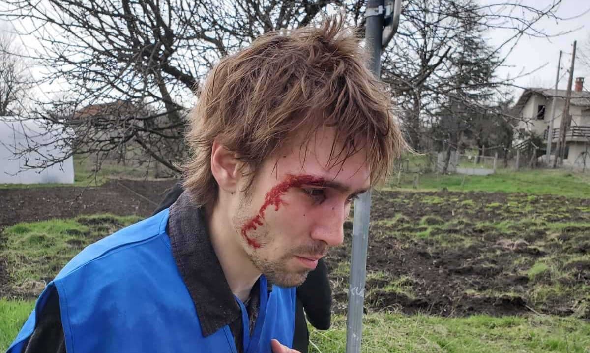 Novinarski deo SRG: Nastavlja se prebijanje novinara i građana, nedopustivo ponašanje policije